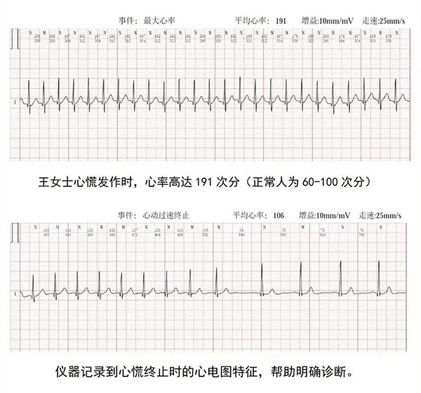 心脏侦探ER1找出真凶