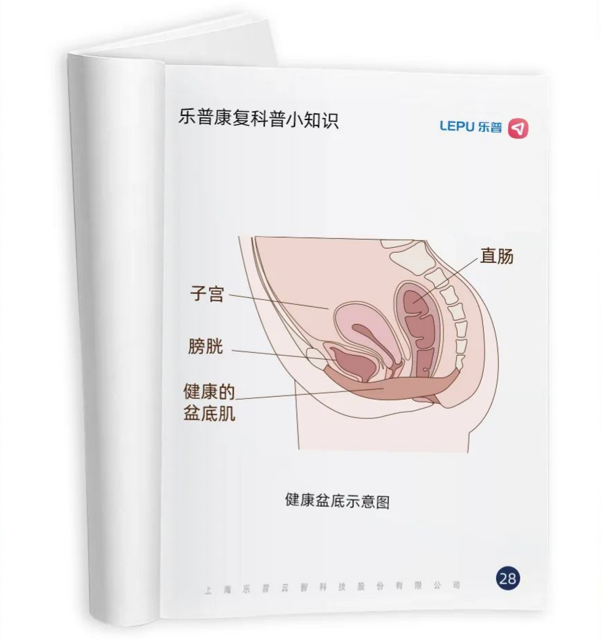 做盆底康复有用吗