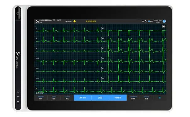 NeoECG系列心电图机