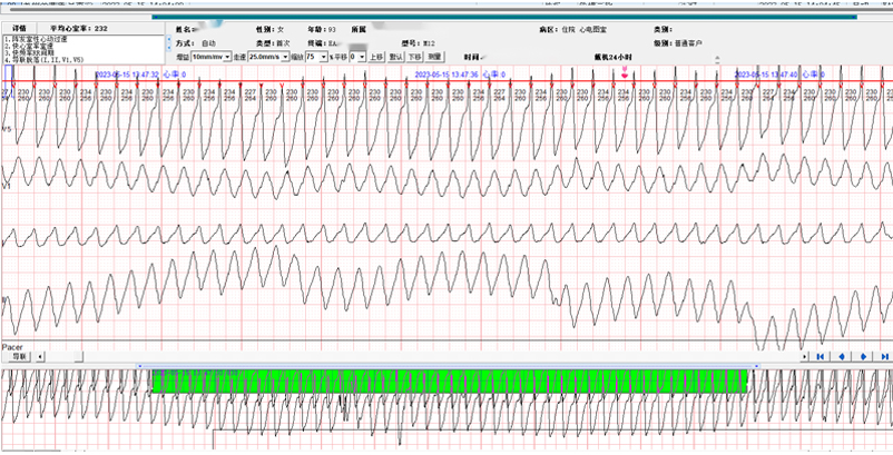 院内心脏数据监护中心发出紧急报警