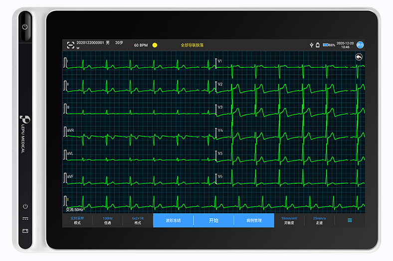 NeoECGT120平板便携式心电图机