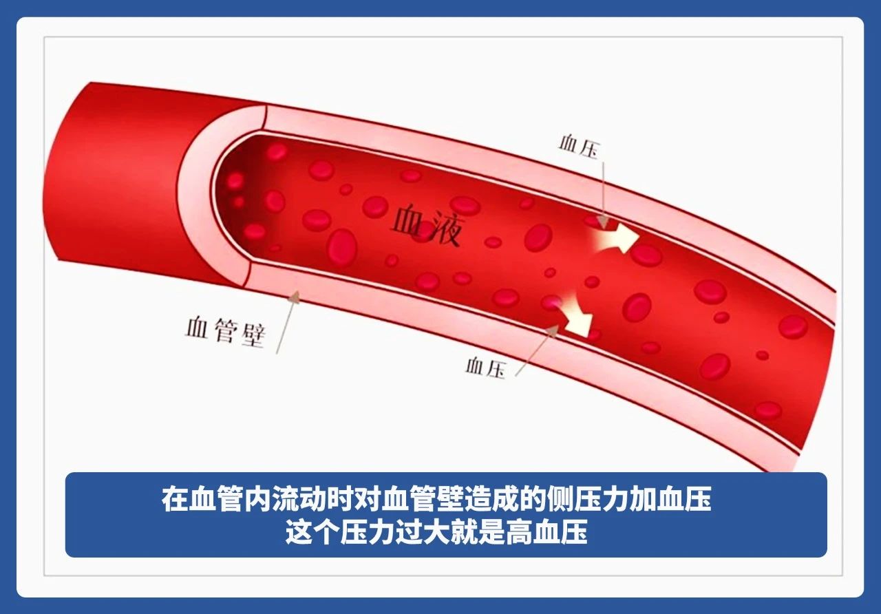 为什么冬季心梗易高发