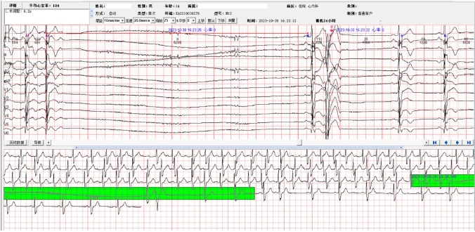 Weixin Screenshot_20240401161137.png