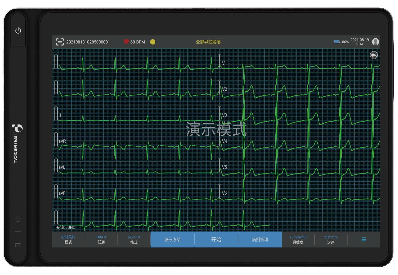 乐普心电一张网