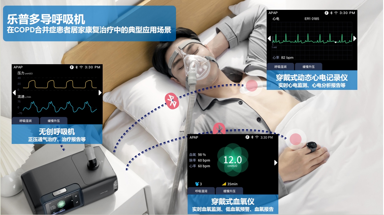 AI远程医疗在COPD患者康复中的应用价值